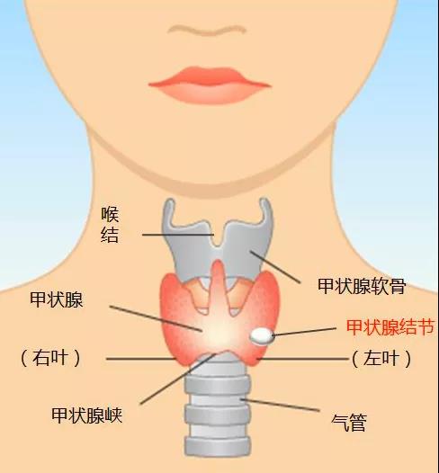 甲狀腺結(jié)節(jié).jpg